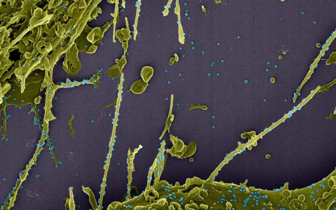 Subvariante da Ômicron é mais infecciosa que “original”, diz estudo