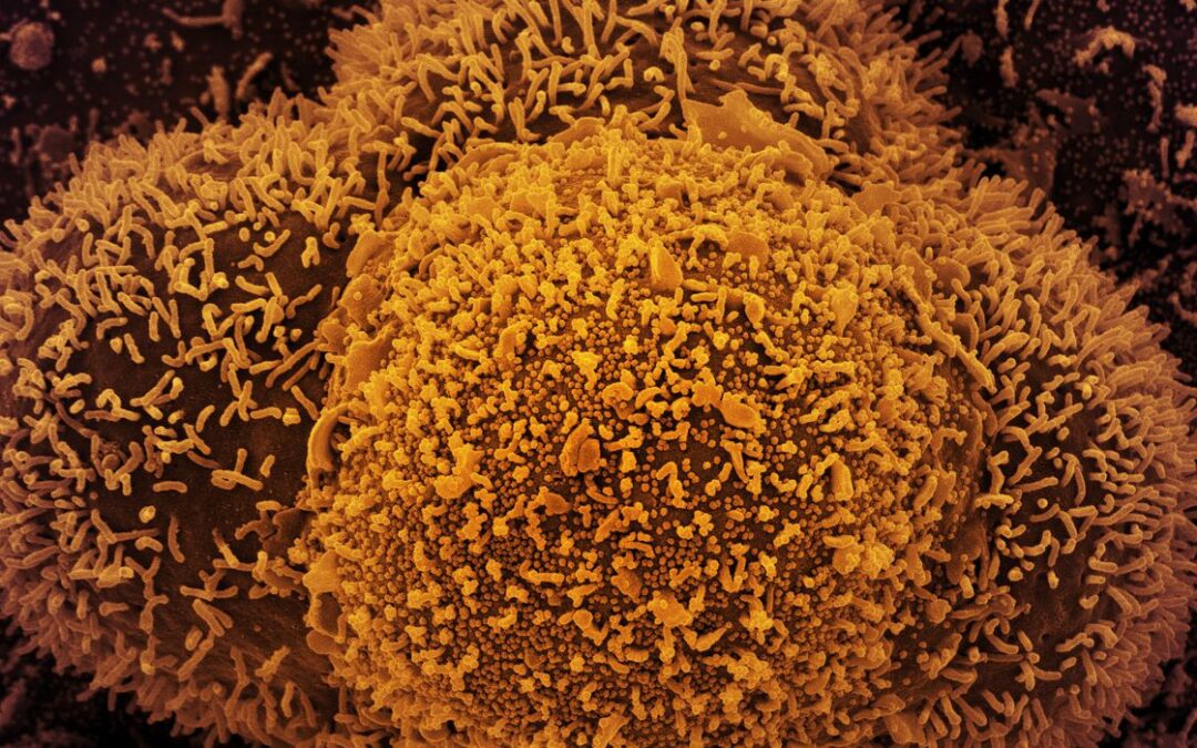 Fiocruz confirma casos da linhagem BA.2 da variante Ômicron