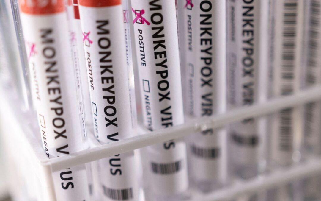 São Paulo confirma primeiro caso de varíola dos macacos no Brasil