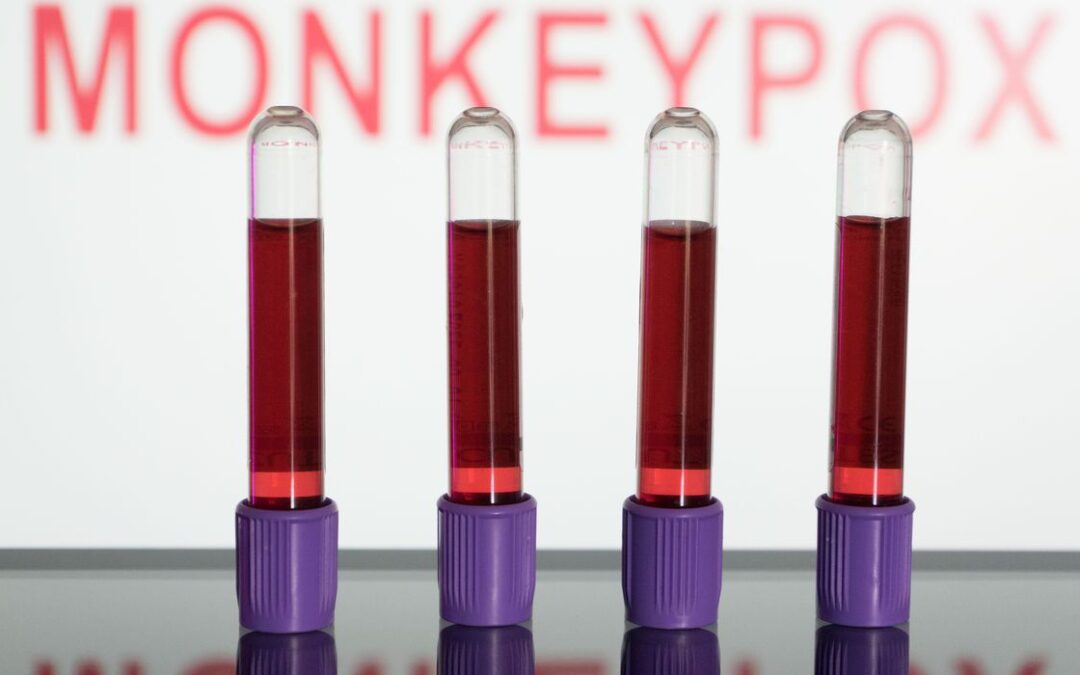 Primeiras vacinas contra varíola dos macacos devem chegar em setembro