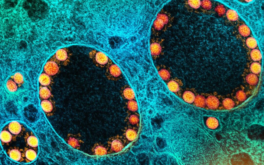 Fiocruz confirma subvariante Ômicron BQ.1 na cidade do Rio de Janeiro