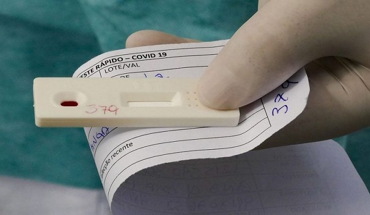 MS registra 492 casos novos por Covid-19