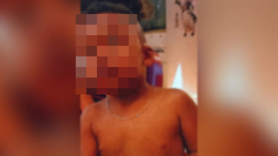 São Gabriel: Menino de 6 anos morre após sofrer queimaduras em acidente doméstico